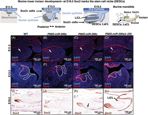 The miR-200 family regulates Sox2 expression in the stem cell niche. A depiction of lower incisor early development is shown in the top panel. The dental epithelial cells invaginate from a dental placode into the mandible and Sox2+ cells become localized to the LaCL by E16.5. The LaCL contains the dental epithelial stem cells (DESCs) which produce progeny to populate the cell layers of the continuously growing rodent incisor. A-D, Sox2 is expressed in the oral epithelium and dental placodes of WT and inhibitor mice at E11.5. E-H, At E13.5, Sox2 is expressed in the oral epithelium as well as in a subset of posterior lower incisor tooth bud cells. The inhibition of miR-200c and the entire miR-200 family results in a smaller tooth bud. When the entire miR-200 family is inhibited, every cell in the lower incisor tooth bud is Sox2+ at this stage. I-L, At E16.5, in WT and PMIS-miR-200a embryos, Sox2 expression is compartmentalized within the labial cervical loop and only expressed by DESCs. When the miR-200c functional group is inhibited, Sox2 expression is decompartmentalized, and transient amplifying cells as well as stellate reticulum cells are Sox2+. In PMIS-miR-200a/c lower incisors the entire, expanded cervical loop region is Sox2+. Sox2 is expressed in the transient amplifying (TA) region as stratum intermedium (SI), stellate reticulum (SR), and lingual cervical loop (LiCL)