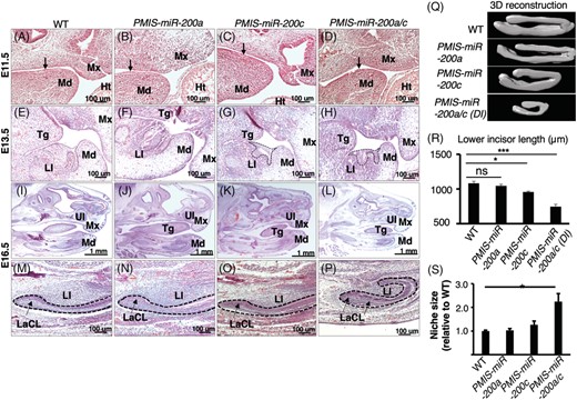 miR-200 family inhibition regulates incisor tissue composition and length. A-D, Hematoxylin and Eosin (H&E) staining of WT, PMIS-miR-200a, PMIS-miR-200c and PMIS-miR-200a/c embryos at E11.5. E-H, H&E staining of WT, PMIS-miR-200a, PMIS-miR-200c and double inhibitor lower incisors at E13.5 revealed smaller tooth buds in PMIS-miR-200c and double inhibitor embryos. I-L, The heads of E16.5 inhibitor embryos were similar in size and grossly similar, containing upper and lower incisors, the tongue, palate and sinus cavity. M-P, Higher magnification of the PMIS-miR-200a/c lower incisor revealed an expanded labial cervical loop region compared with WT, PMIS-miR-200a and PMIS-miR-200c embryos. Q, The dental epithelial tissue from serial sections composing the entire lower incisor for each embryo was traced and Imaris imaging software was used to create 3-D models. R, Lower incisors from three different embryos of each genotype were measured and PMIS-miR-200c and PMIS-miR-200a/c lower incisors are shorter (N = 3, *P < .05, ***P < .01). S, Quantitation of the size of the LaCL stem cell niche relative to WT is shown. Md, Mandible; Mx, Maxilla; Ht, Heart; Tg, Tongue; LI, Lower incisor; UI, upper incisor; LaCL, Labial Cervical Loop
