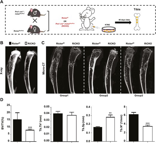 Rictor ablation in BMSCs attenuates osteoblastic lesions caused by osteosarcoma (OS) cell K7M2 injection in vivo. (A) Schematic diagram of OS mouse model preparation. Total 17 successful sex-matched littermate pairs (Rictorf/f, n = 10; RiCKO, n = 7) with transplanted osteosarcoma were obtained. Representative images of tibias with OS detected by (B) X-ray, and (C) micro-CT in longitudinal sections. The wireframes show the sites of OS. (D) Trabecular bone parameters in proximal tibia as seen on micro-CT. Data indicate mean ± SD of triplicates from individual mice **P < .01, ***P < .001.
