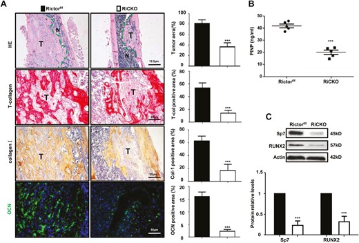 Rictor ablation in BMSCs lessens pathological osteogenesis in vivo. (A) Representative images and quantification of hematoxylin-eosin (HE), total collagen, collagen-I(Col-I), and osteocalcin (OCN) staining. T means tumor. (B) Serum PINP levels. (C) Western blot analyses and quantification of osteogenesis-related proteins extracted from tibial tissue with osteosarcomatous lesions. The protein expression levels are calculated as a ratio to the actin protein level and expressed relative to levels in group of Rictorf/f. ***P < .001.