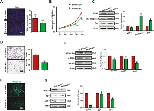 Lower capacities of proliferation, migration and osteogenesis in K7M2 cells are verified after incubating in the culture supernatant of Rictor-deficient BMSCs. K7M2 cells were incubating in the culture supernatant of BMSCs (BCM) for 72h, the medium was changed every 24 hours, thrice. (A) Representative images of EdU staining and quantification of EdU-positive cells relative to total cells. BCM Rictorf/f, K7M2 cells were cultured in BCM derived from Rictorf/f BMSCs; BCM RiCKO, K7M2 cells were cultured in BCM derived from Rictor-deficient BMSCs. (B) The growth and proliferation of K7M2 cells were investigated using the MTT method. (C) Western blot analyses and quantification of proliferative and apoptotic proteins extracted from K7M2 cells after culturing in BCM for 72 hours. The protein expression levels were calculated as a ratio to the Actin protein level and expressed relative to levels in the BCM Rictorf/f group. (D) Representative images and calculated number of migratory K7M2 cells. (E) Western blot analyses and quantification of migration or infiltration-associated proteins extracted from K7M2 after culture in BCM for 72 hours. (F) Representative images of vimentin staining of K7M2 after culture in BCM for 72 hours. (G) Western blot analyses and quantification of osteogenesis-related proteins extracted from K7M2. *P < .05; **P < .01; ***P < .001.