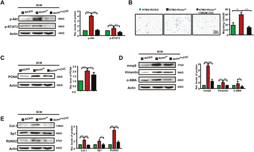 Bioactivity of K7M2 cells can be blocked by CVC. (A) Western blot analysis and quantification of phosphorylation of STAT3 (Tyr705) and Akt (ser473). (B) Representative images and calculated number of migratory K7M2 cells are shown. Western blot analyses and quantification of proteins concerned with proliferation (C), migration (D), and osteogenesis (E). *P < .05; **P < .01; ***P < .001.
