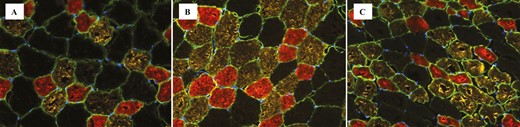 Muscle fiber cross-sections stained by myosin heavy chain (MHC) isoform (MHC-I, oxidative = red; MHC-IIa, oxiglycolytic = yellow; MHC-IIx, glycolytic = black) from different cattle types: (A) conventional beef; (B) crossbred beef × dairy; (C) dairy.