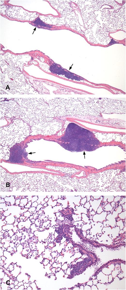 Lung histology of control- and DAS181-treated rats. Histological examination of the lungs of rats treated with lactose (A) and 3 mg/kg/day of DAS 181 (B and C) on day 29, hematoxylin and eosin stain. (A) BALT (arrow) of lactose control, ×40. (B) Increased size/cellularity of the BALT (arrow) is present compared with lactose control (A), ×40. (C) Accumulation of foamy macrophages in the bronchoalveolar junction and alveoli, ×200.