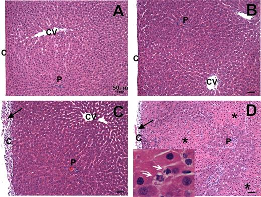 Hepatic histopathology. Rats were treated with AMD (400 mg/kg, ip) or vehicle and 16 h later with LPS (1.6 × 106 EU/kg, iv) or saline. Liver tissue samples were collected at 10 h after LPS administration. Formalin-fixed liver samples were embedded in paraffin, sectioned, and stained with H&E staining. Treatment groups: (A) vehicle/sal; (B) vehicle/LPS; (C) AMD/sal; (D) AMD/LPS. CV, central vein; P, portal vein; C, capsule. Black arrows indicate fibrinopurulent capsulitis; * depicts necrotic foci. Inset in panel D is a higher magnification photomicrograph from a rat treated with AMD/LPS demonstrating neutrophils (white arrows).