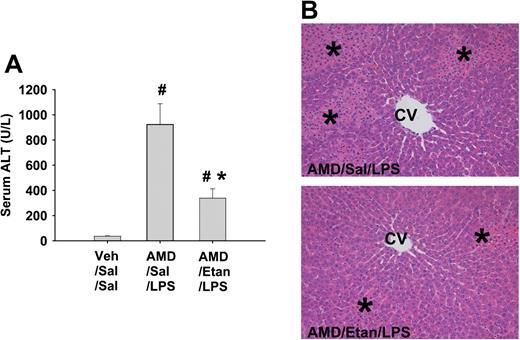 Effect of TNF inhibition on AMD/LPS-induced liver injury. Rats were treated with AMD (400 mg/kg, ip) or vehicle and 16 h later with LPS (1.6 × 106 EU/kg, iv) or saline. Etanercept (8 mg/kg, sc) or its saline vehicle was given 1 h before LPS. Rats were killed 10 h after LPS. (A) Serum ALT activity. # indicates significantly different from vehicle/Sal/Sal; * indicates significantly different from AMD/Sal/LPS. p <0.05, n = 5–8. (B) H&E-stained liver slides. CV, central vein; * depicts necrotic foci.