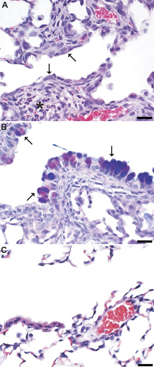 Histopathologic changes after aspiration of furfuryl alcohol in mice sensitized by prior dermal sensitization. In hematoxylin and eosin (H&E)-stained sections of furfuryl alcohol–exposed (pulmonary and dermal) mice (A), the bronchiolar epithelium is hypertrophied, hyperplastic, and mildly disorganized (arrows), and the peribronchiolar interstitium is infiltrated by histiocytes and eosinophils (*). In AB/PAS-stained sections from furfuryl alcohol–exposed mice (B), mucous metaplasia (arrows) is demonstrated by magenta to purple staining of hypertrophied bronchiolar epithelial cells. Vehicle control mice were within normal histologic limits (C; H&E stained section). Bar is 20 μm.