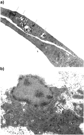 Analysis of nanoparticle uptake with TEM. (a) A representative image obtained from an astrocyte culture treated with 10 μg/ml Ag20Pep for 24 h. Frequently, cells contained large agglomerates of SNP, as depicted by arrows. Magnification 5000×. (b) A representative image obtained from a neuronal-enriched culture treated with 10 μg/ml Ag20Pep for 24 h. Typically, cells do not contain any SNP agglomerates. Occasionally, individual particles or small agglomerates of SNP can be found (arrows). Magnification 3150×.