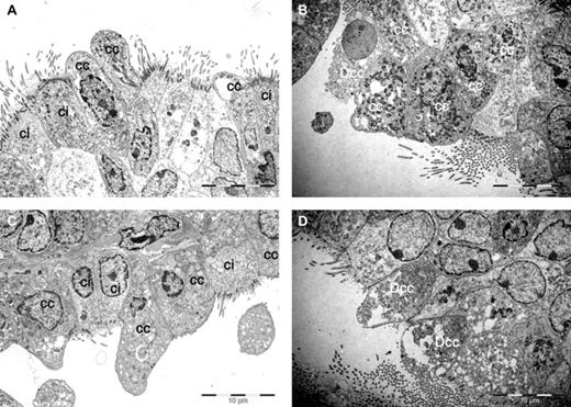 Transmission electron microscopy of the mouse lungs. CC, Clara cell; Ci, ciliated cuboidal epithelial cell; BC, blood capillary; Dcc, disrupted Clara cells. (A and C): Normal bronchiolar epithelium consisting of ciliated cuboidal epithelial cells and nonepitheliated Clara cells. Clara cells are dome-shaped cells with short microvilli within the simple ciliated epithelium. The cytoplasm contains numerous secretory vesicles. (B and D): Increased number of Clara cells, of which many are disrupted. The layers are pseudostratified indicating hyperplasia. The number of smaller and darker basal cells containing secretory vesicles appears to be increased.