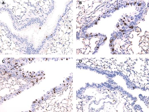 Representative pictures of bronchioles. The number of BrdU-positive cells (intensive dark staining) in fluensulfone- and isoniazid-treated animals is increased compared with control on day 3, returning to base level after treatment with either substance on day 7. (A) Control, (B) Fluensulfone (day 3), (C) Isoniazid (day 3), and (D) Fluensulfone (day 7).