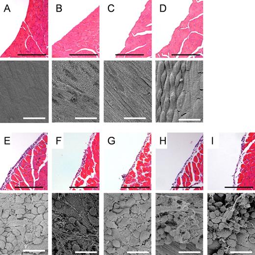 Length-dependent response of AgNW on the parietal mesothelial surface 24 h postinjection. Hematoxylin and eosin histology sections and SEM images of VC (A), mice treated with Ag-P (B), AgNW3 (C), SFA (D), AgNW5 (E), AgNW10 (F), AgNW14 (G), AgNW28 (H), and LFA (I). No alteration on the mesothelial surface can be seen in the mice treated with Ag-P, AgNW3, and SFA. Normal mesothelial cells on the parietal pleura appear either flat as seen in the image of VC-exposed mesothelium or in a more rounded or raised form in areas called the lacunar regions, such as that seen in the image of SFA-exposed mesothelium (Donaldson et al., 2010). Accumulation of inflammatory cells was observed on the mesothelial lining in mice treated with long AgNW (≥ 5 µm) and LFA. Scale bar: black 100 µm; white 20 µm.