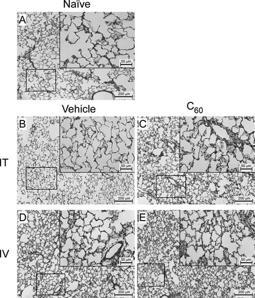 Male rat left lung histology. To visually assess pulmonary responses to C60 exposure in male Sprague Dawley rats, sections of the left lung (8 μm) were stained with H&E and examined by light microscopy at 10× and 40× (inlays) magnification. (A) Representative images from a naïve male rat. (B) Representative images from a male rat intratracheally (IT) exposed to the PVP vehicle. (C) Representative images from a male rat IT exposed to C60. (D) Representative images from a male rat intravenously (IV) exposed to vehicle. (E) Representative images from a male rat IV exposed to C60.