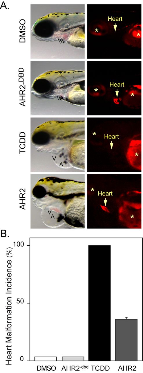 Cardiomyocyte overexpression of AHR2 and heart malformation. Embryos were exposed to vehicle or TCDD just after fertilization or injected with cmlc2:AHR2–2AtRFP or cmlc2:AHR2−dbd-2AtRFP expression constructs. (A) Brightfield and fluorescent images showing lateral views with anterior to the left. The arrow indicates position of the heart and asterisks indicate autofluorescence. (B) The incidence of heart malformation following each treatment: white bar, vehicle (n = 5); black bar, TCDD (n = 5); light gray bar, AHR−dbd (n = 18); and dark gray bar, AHR2 (n = 42). Error bar represents standard error of the mean.