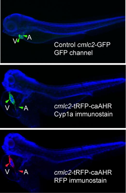 Tissue specificity of cmlc2 promoter. The figures show DAPI-mounted 72 hpf zebrafish. In all panels, the ventricle (V) and atrium (A) are indicated by arrows. The top panel shows a wild-type embryo expressing GFP from the cmlc2 promoter. The middle panel shows an embryo injected with the cmlc2:caAHR-2AtRFP DNA, stained with anti-cyp1a antibodies shown as green. The same fish is shown in the bottom panel with the tRFP indicated by red fluorescence. Close examination shows the signal restricted to the heart in both specimens.