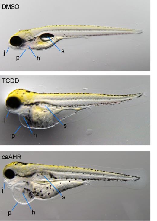 Cardiomyocyte expression of caAHR reproduces many of the effects of TCDD. Wild-type AB embryos were exposed to vehicle (A) or TCDD (B) immediately after fertilization. Tg(cmlc2:caAHR-2AtRFP) embryos (C) were collected from in-crossing founders. Representative individuals are shown, photographed at 96 hpf, n = 5 for each condition. Jaw, j; pericardium, p; heart, h; swim bladder, s.