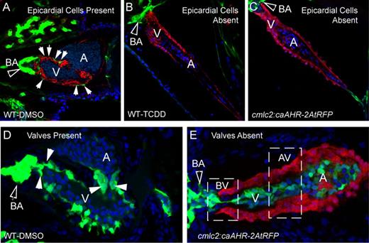 Effect of caAHR expression in cardiomyocytes on epicardium, BA, and valve development. (A–C) Transgenic caAHR founders (cmlc2:caAHR-2AtRFP) or wild-type controls (AB) were crossed with Tg(pard3:EGFP) reporter fish marking the epicardial cells. (A) Wild-type x Tg(pard3:EGFP) offspring treated with DMSO, (B) wild-type x Tg(pard3:EGFP) treated with TCDD as described in the Materials and Methods. Embryos were collected and stained with antibodies against ALCAM (red) and stained with DAPI (blue), and representative images are shown, n = 7; 120 hpf. (C) Offspring of cmlc2:caAHR-2AtRFP founder crossed with Tg(pard3:EGFP) reporter fish. caAHR expression in the myocardium is indicated by the red RFP signal; epicardial and BA cells are green. The filled arrows indicate the BA; white solid arrows indicate normal epicardial cells. (D–E) Wild-type (AB) or transgenic caAHR founders (cmlc2:caAHR-2AtRFP) were crossed with Tg(flk1:EGFP) reporter fish. (D) Wild-type x Tg(flk1:EGFP) offspring. (E) Offspring of cmlc2:caAHR-2AtRFP founder crossed with Tg(flk1:EGFP) reporter fish. The filled arrows indicate the BA; white solid arrows indicate normal valve cushions. n = 7; 96 hpf.