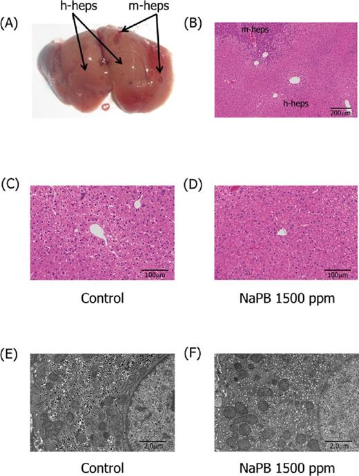 Liver gross pathology and histology in chimeric mice. Photographs present gross (A) and histological (B) appearance of livers of control chimeric mice, with h-heps and m-heps representing human hepatocytes and mouse hepatocytes, respectively. Histopathology (C, D) and ultrastructure (E, F) of human hepatocyte-originated areas of chimeric mice given 0 (C, E) and 1500 ppm (D, F) NaPB are also presented. Centrilobular hepatocellular hypertrophy (D) and proliferation of the smooth endoplasmic reticulum (F) was observed in NaPB-treated chimeric mice. Actual incidences of liver histopathology are shown in Supplementary Data.