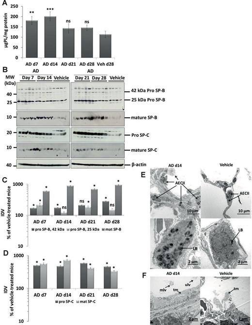 Accumulation of surfactant in AD-treated lung tissues. (A) Total PLs were extracted from lung tissue of all AD- and vehicle-treated mice. The resulting PL concentrations were normalized against their respective protein concentrations and values are expressed as micrograms of PLs per milligram of protein. (B) Western blot analysis of lung homogenates of (left) AD-treated mice at days 7,14 and vehicle at day 28 and (right) AD-treated mice at days 21, 28, and vehicle at day 28 for prosurfactant protein (SP)-B, mature SP-B, pro–SP-C, and mature SP-C. Representative blots are from n = 5 mice per group and results of three independent experiments are shown. (C and D) Densitometry was performed on all Western blot analyses. The target protein/β-actin ratio was calculated and is given as a percentage of the respective vehicle-treated controls. ***p < 0.001,**p < 0.01, *p < 0.05; n = 5 mice per group. Representative blots and analysis from n = 5 mice per group and three independent experiments are shown. (E) Representative transmission electron micrographs showing increased number and size of profiles of AECII (hyperplasia; arrows) d14 post AD challenge compared with vehicle-treated mice. AECII filled with abundant and enlarged profiles of lamellar bodies (LB) are shown. Scale bar = 10 μm (upper panel); 2 μm (lower panel). (F) Alveolar areas filled with surfactant in some areas appeared more prominent in AD-treated mice lungs (left panel) as compared with vehicle-treated mice lungs (right panel). tm, tubular myelin; mlv, multilamellated vesicles; ulv, unilamellated vesicles. Scale bar = 2 μm.
