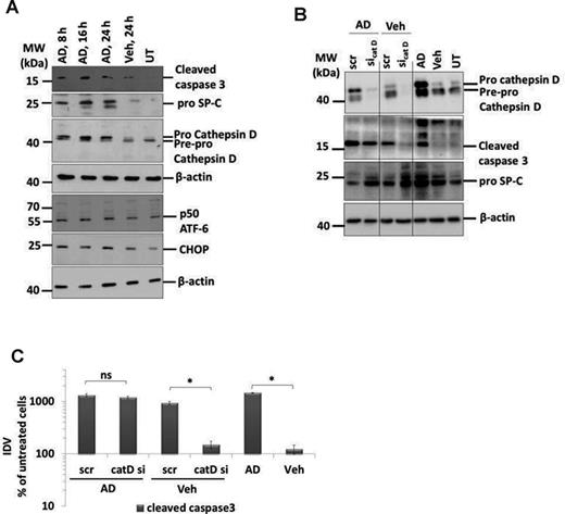 AD-induced AECII apoptosis is not mediated by cathepsin D. (A) Representative Western blot images from cell lysates from AD (8, 16, and 24 h) or vehicle-treated (24 h) or untreated MLE12 cells for cleaved caspase 3, cathepsin D, pro SP-C, ATF6, CHOP, and β-actin. (B) Representative Western blot images for cathepsin D, cleaved caspase 3, pro SP-C, and β-actin from MLE12 cells treated with AD or vehicle and transfected with scrambled or siRNA for cathepsin D. Untransfected cells treated with AD, vehicle, or untreated cells were included as controls. Different parts from same Western blots are separated by vertical lines. (C) Densitometry analysis of cleaved caspase 3 to β-actin ratio was calculated and is given as a percentage of untreated cells. *p < 0.05. Representative images and densitometry analysis from three independent experiments with triplicate transfections each are shown.