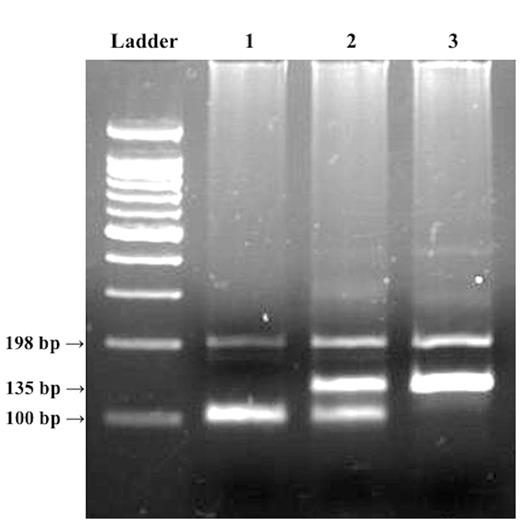 Representative gel for MT2A A-5G polymorphism. Ladder, 100-bp ladder; lane 1, AA genotype with 100-bp band; lane 2, GA genotype with 100- and 135-bp bands; lane 3, GG genotype with 135 bp band. The polymerase chain reaction was conducted with a PCR-CTPP method that discriminates genotypes by the product lengths of PCR using 2 sets of primer pairs. The product of primers F1 and R1 has a length of 135 bp, where the antisense sequence of the G allele is included in the 3′ end of the R1 primer. The product of primers F2 and R2 has a length of 100 bp, where the A allele is included in the 3′ end of the F2 primer. The band at 198 bp is a common band, which is the PCR product of F1 and R2 primers.