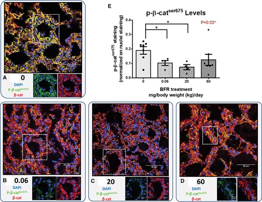 Localization of endogenous β-catenin and p-β-catser675 in mammary glands from the dams. Cryosections were cut (7 µm) and processed for immunofluorescence staining. A–D, Nuclei were stained with DAPI (blue). β-catenin (red) and p-β-catser675 (green) co-localized at the membrane, and the levels of p-β-catser675 differed dramatically in control and BFR-exposed animals. Images were obtained with a Nikon A1R+ equipped with a spectral detector and analyzed using NIS-elements software. E, The columns represent the means ± SEM (n = 4–7) for p-β-catser675 staining normalized to nuclei staining. p-values were calculated with a Kruskal-wallis statistical test. *p ≤ .05.