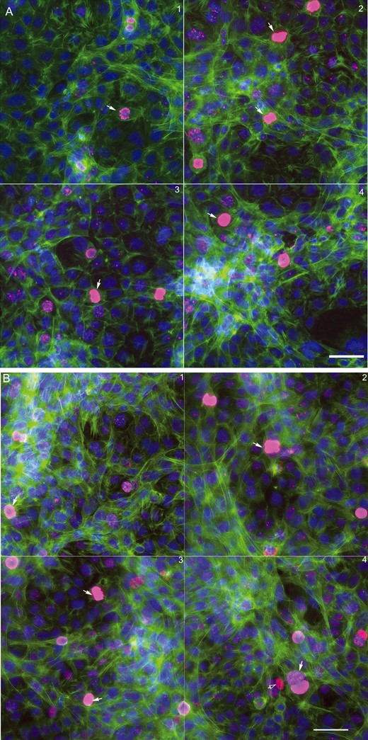 Morphological comparison between the testicular coculture model (A,B) and single cell culture models, including spermatogonia (C), Leydig cells (D) and Sertoli cells (E). The testicular cell coculture model consisted of 3 cell types: Spermatogonial cells (C18-4), Leydig cells (TM3), and Sertoli cells (TM4); the morphological images of coculture are shown in (A; 48 h) and (B; 72 h). Single cell cultures of spermatogonial (C18-4, C), Leydig (TM3, D) and Sertoli cell culture (TM4 E) are shown at 48 and 72 h. Cells were fixed with 4% paraformaldehyde, stained with antibodies, and automated multi-channel images were acquired using ArrayScan VTI with 40× magnification (Thermo Fisher Scientific, MA). Multi-channel images show the morphology, including nuclear (Hoechst 33 342, blue), cytoskeleton F-actin (phalloidin, green) and mitotic marker phosphor-histone H3 (pink). All experiments included 3 replicates, and were repeated 3 times. White arrows in (A) indicate mitotic cells, and white arrows in (D,E) indicate dividing cells with an F-actin “contract ring”. Scale bars: 50 μm.