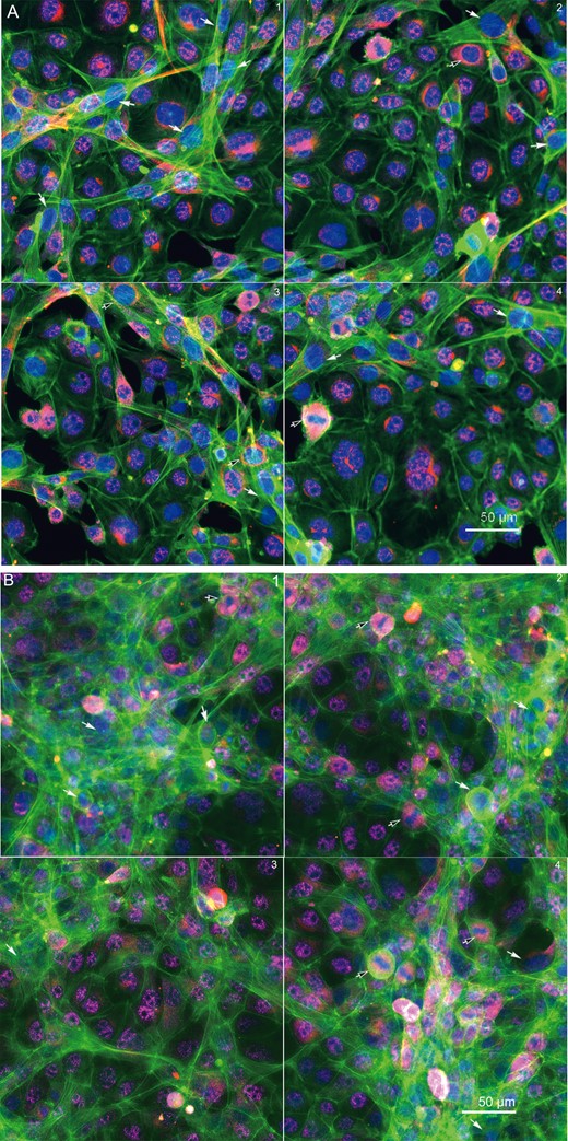 Immunofluorescence of the testicular cell coculture model with cell-type-specific protein markers at 48 h (A) and 72 h (B) postinoculation. Representative images show the 3 cell types of testicular cells in the coculture model. Spermatogonial cells (C18-4) are labeled with a specific mouse GCNA1 (pink staining in nucleus); Leydig cells are labeled with steroidogenic acute regulatory protein (StAR, red staining in cytoplasm, black arrow); and Sertoli cells are labeled with neither GCNA1 nor StAR (white arrow).