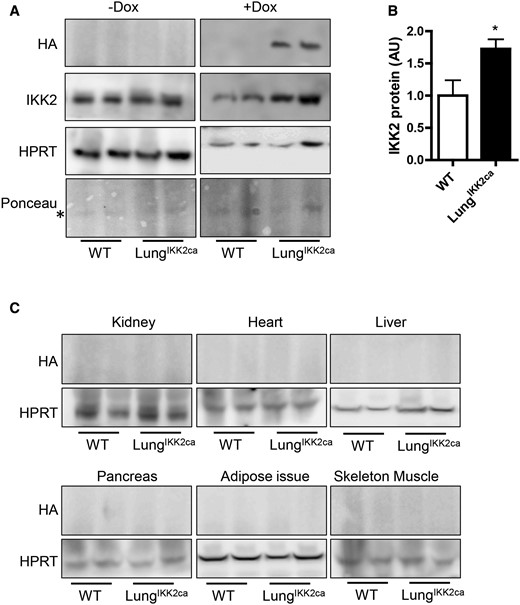 Lung-specific overexpression of IKK2ca induced by doxycycline diet. SFTPC-rtTA+tetO-cre+pROSA-IKK2ca+ (LungIKK2ca) and littermate SFTPC-rtTA+tetO-cre-pROSA-IKK2ca+ (WT) mice were fed with doxycycline (+DOX) or normal (−DOX) diet for one month. The expression of HA-tagged IKK2ca in the lung (A and B) and other major organs (C) were assessed by western blot. The representative images (A) and the summary (B) of IKK2ca expression in the lung are presented (n = 4–8/group). *p < .05 versus WT, student t test. C, The representative images of HA-tagged IKK2ca in the indicated major organs are presented.