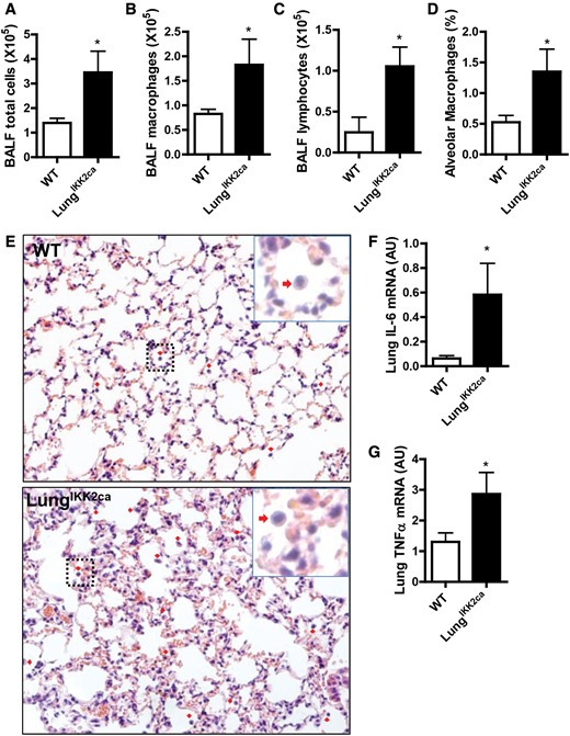Lung-specific overexpression of IKK2ca induces pulmonary inflammation. WT and LungIKK2ca mice were fed with doxycycline diet for 3 months. A–C, BALF cell differentiation. The right lungs were not subjected to lavage and thus used for histological assessments (E) and quantitation (D) of pulmonary inflammation. ↓Macrophages. Scale bar, 100 µm. F, G, qPCR analyses of proinflammatory cytokine expression in the lung (n = 6 or 8). *p < .05 versus WT, student t test.