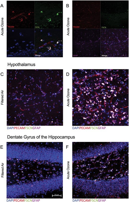 Microscopy reveals overlapping blood–brain barrier (BBB) impairment and astrocyte activation at the neurovascular unit following acute O3 exposure. A, Representative image of the BBB in the hypothalamus of an aged, O3-exposed brain taken at ×63; PECAM (red) indicates vasculature, FSCN (green) indicates FSCN dye penetration into the brain parenchyma, DAPI (blue) indicates nuclear staining, and the Merge (white) shows overlap indicative of FSCN leakage from the vessels (overlap of PECAM and FSCN). B, Representative image of the BBB and astrocyte activation in the hypothalamus of an aged, FA-exposed animal taken with a ×63 objective; GFAP (purple) indicates astrocytes that are co-localized with the FSCN dye (FSCN, green) and vasculature (PECAM, red) in the Merge image (white). C, The Merge image from (B) in greater detail (×100). D, Representative Merge image of the aged hypothalamus after acute O3 exposure. E, Representative Merge image of the aged dentate gyrus at ×100. F, Representative Merge image of the aged dentate gyrus after acute O3 exposure at ×100. Potential uptake or overlap of the FSCN and GFAP (white) is demonstrated by (C)–(F).