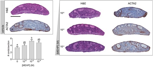 MEHP alone increased or had no effect on seminiferous cord number. Representative images of cultured fetal testes exposed to a concentration range of MEHP for 3 days, stained with hematoxylin and eosin (H&E) or immunohistochemically labeled for smooth muscle alpha actin (ACTA2). Scale bar = 200 µm. The impact of MEHP on the number of seminiferous cords per section was not concentration dependent, but 10−5 M MEHP significantly increased cord number versus vehicle. Many cords in MEHP-treated testes had irregular morphology. Values reported in chart are mean ± SEM. n = 17 testes in vehicle control group and 6–7 testes per treated group. Bars not connected by the same letter are significantly different (p < .05) by 1-way ANOVA followed by Tukey’s post hoc test. Overall ANOVA p = 0.0159. The full-color image is available online.