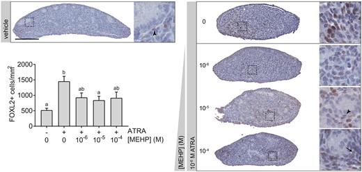 ATRA-mediated induction of FOXL2 was weakly opposed by MEHP. Vehicle-treated testis cultures exhibited little FOXL2 expression on day 3 of culture. Across all samples, most FOXL2-positive cells appeared in the interstitium. However, some weakly positive cells appeared to be possible Sertoli cells (arrow) or peritubular myoid cells (arrowheads) based on localization and nuclear morphology. ATRA exposure significantly increased the number of FOXL2-positive cells per unit area in 3-day fetal testis cultures. With addition of MEHP, FOXL2-positive cells appeared to be reduced in number and intensity. This decrease was significant with addition of 10−5 M MEHP. On x-axis, “−” indicates no ATRA; “+” indicates 10−6 M ATRA. Bars not connected by the same letter are significantly different (p < .05) by 1-way ANOVA followed by Tukey’s test. Overall ANOVA p = .0002. Chart depicts mean ± SEM of 12 testes in vehicle control group and 3 testes per treated group. Scale bar = 200 µm. The full-color image is available online.