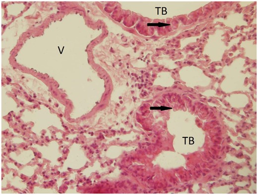 A goblet cell hyperplasia at the terminal bronchioli of the lungs (indicated by the arrow) of animals after 3 months exposure to 1.93 × 106 ZnO NP/cm3. This finding, not observed in the control group, may be related to irritation as a consequence of ZnO NP inhalation. Abbreviations: TB, terminal bronchioli; V, vessel.