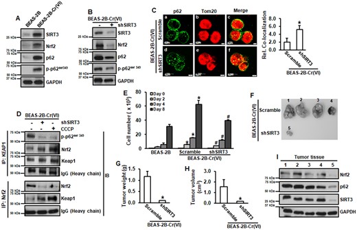 Upregulation of SIRT3 elevates p62 and Nrf2, leading to increased cell proliferation and tumorigenesis of Cr(VI)-transformed cells. A and B, Whole protein lysates from passage-matched normal BEAS-2B and Cr(VI)-transformed cells transfected with or without shSIRT3 were subjected to immunoblotting analysis. C, Cr(VI)-transformed cells transfected with or without shSIRT3 were subjected to fluorescence immunohistochemistry analysis. Relative colocalization was measured. Images were represented 1 sample in each treatment group (Left). Fluorescence intensities were quantitated (Right). Data are expressed as mean ± SD (n = 3). *p < .05 compared with that in Cr(VI)-transformed cells (Scramble). D, Whole protein lysates from Cr(VI)-transformed cells transfected with or without shSIRT3, or treated with 5 µM of CCCP for 4 h were subjected to coimmunoprecipitation analysis. E, Passage-matched normal BEAS-2B and Cr(VI)-transformed cells with or without shSIRT3 were seeded in 6-well plates for 2, 4, and 8 days and total cell number was counted. Data are expressed as mean ± SD (n = 3). * and #, p < .05 compared with that in BEAS-2B cells or Cr(VI)-transformed cells, respectively at the same day. F–H, 6–8 weeks old female immuno-deficient mice were subcutaneously injected with Cr(VI)-transformed cells with or without shSIRT3. After 3 weeks, tumor volumes were measured (H). Tumor tissues were isolated. Tumors were pictured (F) and weighted (G). Protein lysates were extracted from tumor tissues for immunoblotting analysis (I). G and H, Data are expressed as mean ± SD (n = 4). *p < .05 compared with that in Cr(VI)-transformed cells.