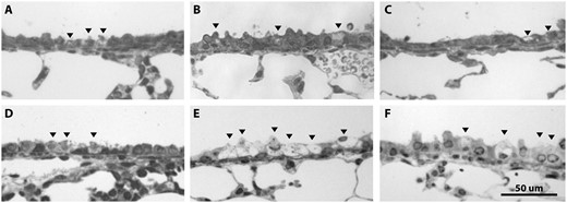 Proximal airway epithelial damage (swelling and vacuolization) was evident at all ages following 10-ppm NA exposure, but was most severe for the juvenile female group. A, Neonatal male, B, juvenile male, C, adult male, D, neonatal female, E, juvenile female, and F, adult female. These representative images show sex and age differences in cellular vacuolization and swelling for the proximal airways following 10-ppm NA exposure (n = 5). Black arrowheads show damaged Club cells.