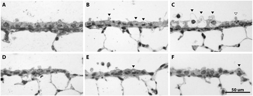 The extent and severity of NA damage was greater in the proximal airways than in the terminal bronchioles (distal airways). A, Naive proximal airway, B, proximal airway at 5 ppm, C, proximal airway at 10 ppm, D, naive terminal bronchiole, E, terminal bronchiole at 5 ppm, and F, terminal bronchiole at 10 ppm. These representative images show the pattern of dose-dependent cellular damage following NA inhalation for juvenile female mice. Cytoplasmic vacuoles were present in all airway levels beginning at 5 ppm, with increased vacuolization in the proximal airways at 10 ppm. Many Club cells in the juvenile female proximal airways were swollen. Black arrowheads show damaged Club cells; white arrowhead shows undamaged Club cell for size reference at 10 ppm.