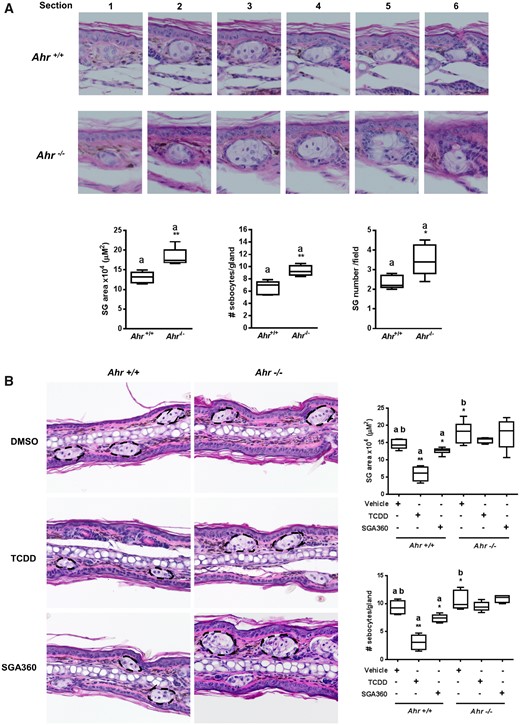 Topical application of AHR ligands reduces the size of sebaceous glands in mouse ears. A, After 14 days of topical application of TCDD or SGA360, mouse ears were sectioned, and H&E stained. B, Serial ear sections were taken to determine the largest middle section of glands in order to measure a cross-sectional area. Data are presented as mean ± SD, n = 3; significance was determined by one-way ANOVA.