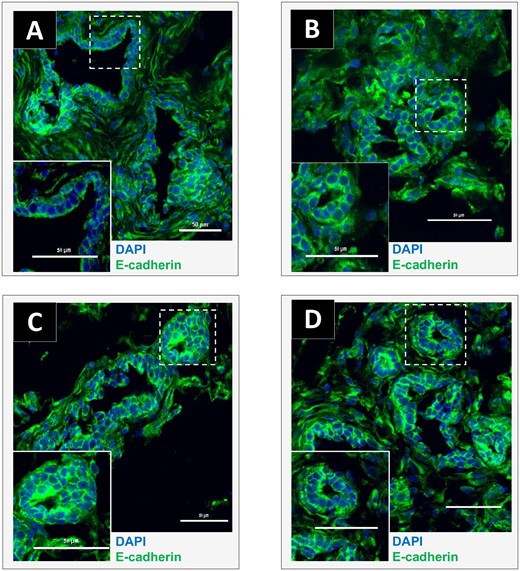 Effects of exposure to a brominated flame retardant (BFR) mixture on E-cadherin localization in the mammary glands of offspring at postnatal day (PND) 46. Cryosections were cut (7 µm) and processed for immunofluorescence staining from vehicle controls (A) or animals from the 0.06 (B), 20 (C), or 60 (D) mg/kg/day BFR mixture treatment groups. Nuclei were stained with 4′, 6-diamidino-2-phenylindole (DAPI) (blue). E-cadherin (green) was localized at the membrane and no apparent changes were noted in its protein levels or localization among groups. Images were obtained with a Nikon A1R+ equipped with a spectral detector and analyzed using NIS-elements software. (Color version of this figure is available at Toxicological Sciences online.)