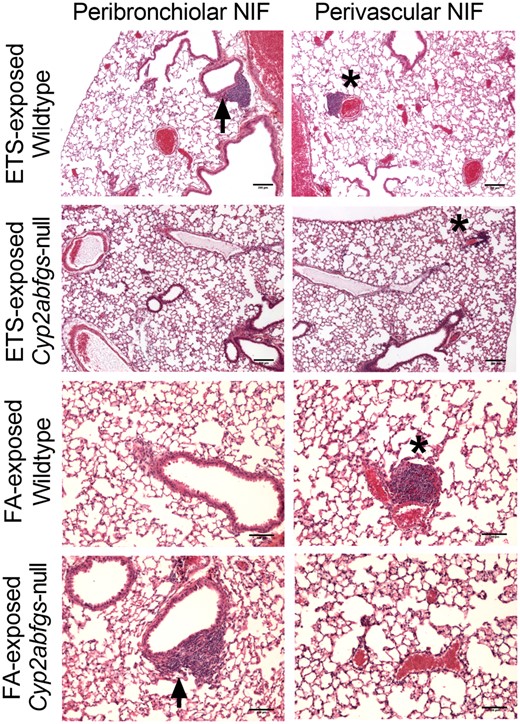 Histopathologic evaluation of lung tissue from wildtype (WT) and Cyp2abfgs-null mice following exposure to filtered air (FA) or environmental tobacco smoke (ETS) via inhalation. Paraffin-embedded, formalin-fixed lung tissue sections from WT and Cyp2abfgs-null mice (adult female, n = 3) were H&E stained and evaluated for the occurrence of pathological changes following 1 week of daily FA or ETS inhalation exposures as described in Materials and Methods section. Representative images of nodules of inflammations (NIFs) from ETS-exposed WT and Cyp2abfgs-null mice are shown at ×4 magnification. Scale bar is 200 µm. NIFs were observed in both peribronchiolar (arrow) and perivascular (*) regions of ETS-exposed WT mice. However, NIFs were observed only in perivascular, but not in peribronchiolar, regions of ETS-exposed Cyp2abfgs-null mice. Images of NIFs observed in FA-exposed WT and Cyp2abfgs-null mice are shown at ×10 magnification with a 100 µm scale bar.