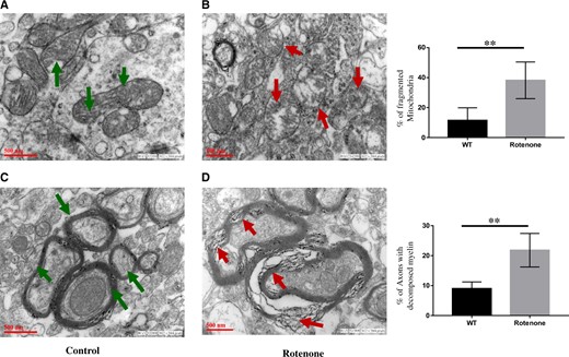 Four-week rotenone exposure (2.5 mg/kg b.wt) disrupted mitochondrial morphology in substantia nigra (SN) of 1‐year‐old rat brains. Electron micrographs of SN isolated from control (A and C) rats and rotenone exposed (B and D) rats. Green arrows in (A) demonstrating normal mitochondrial structure, and (C) normal myelination in SN of control rats. In SN of 4-week rotenone (2.5 mg/kg b.wt) exposed rats, red arrows show fragmented mitochondria (B) or decomposed or degraded myelin structure (D). Bar diagrams of % of fragmented mitochondria and % of axons with decomposed myelin’s are represented in panel (E). Scale bar 500 nm. **p < .01.