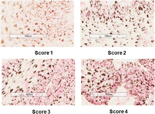 Examples of scoring 1–4 for intensity of nuclear pink color, indicating PAH-DNA damage. Whales shown here are: PM99-454 (Sea of Cortez) for Score 1; WO141 (Gulf of Mexico) for Score 2; WO148 (Gulf of Mexico) for Score 3; and WO139 (Gulf of Mexico) for Score 4.