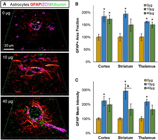 Pulmonary MWCNT exposure increased astrocyte reactivity across multiple brain regions. Brain tissues collected 4 h after exposure were stained with the astrocyte marker GFAP (red), the BBB permeation marker albumin (green), and the cerebrovasculature marker ZO1 (magenta). A, Representative GFAP staining proximal to cerebrovasculature are shown from striatum. B, The percent area within 100 µm of the ZO1 defined vessel wall was assessed across neocortex, striatum and thalamus, relative to the 0 µg control exposure group. C, The fluorescent intensity of GFAP staining within 100 µm of the vessel wall was assessed relative to the 0 µg control exposure group within neocortex, striatum, and thalamus. Data are presented as mean ± SEM, n = 6/group. *p < .05 within dose relative to 0 µg control; #p < .05 across brain regions;ǂp < .05 between doses within a brain region. Scale bar = 20 µm.
