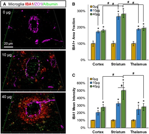 Pulmonary MWCNT exposure increased microglial reactivity across multiple brain regions. Brain tissues collected 4 h after exposure were stained with the microglial/macrophage marker IBA1 (red), the BBB permeation marker albumin (green), and the cerebrovasculature marker ZO1 (magenta). A, Representative IBA1 staining proximal to cerebrovasculature are shown from striatum. B, The percent area within 100 µm of the ZO1 defined vessel wall was assessed across neocortex, striatum, and thalamus, relative to the 0 µg control exposure group. C, The fluorescent intensity of IBA1 staining within 100 µm of the vessel wall was assessed relative to the 0 µg control exposure group within neocortex, striatum, and thalamus. Data are presented as mean ± SEM, n = 6/group. *p < .05 within dose relative to 0 µg control; #p < .05 across brain regions; ǂ,p < .05 between doses within a brain region. Scale bar = 20 µm.