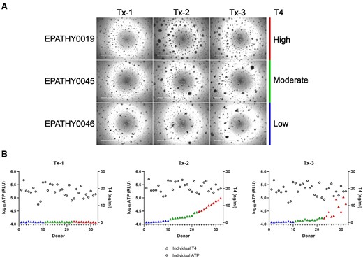 Summary characterization of microtissue morphology at day 14. A, Representative brightfield micrographs from a high (EPATHY0019), moderate (EPATHY0045), and low (EPATHY0046) T4-producing donor across the 3 treatment groups (Tx-1, Tx-2, Tx-3). Scale bar is 1000 µM. B, The log10 ATP relative light units (RLU) across the 3 treatment groups (Tx-1, Tx-2, Tx-3) plotted with each independent donor T4 concentration (ng/ml) (color-coded triangles) at day 14.