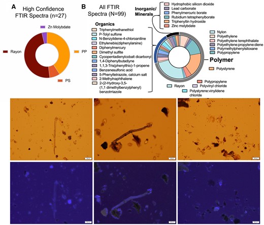 Top, representative results of FTIR-based characterization of particles and fibers from these samples confirms presence of polymers but also mineral-based solids. Shown are distributions of particles rendering spectra with high confidence identifications (A) and all particles, even including lower confidence spectra (B). Bottom, light microscopy examples, combined with UV light illumination for polymers, illustrates numerous probable particulates remaining in pellet after tissue saponification and ultracentrifugation. Various sized particles and fibers are easily detected in placental tissue. Scale bar indicates 50 µm.