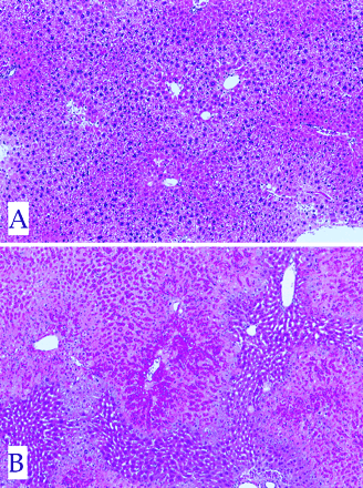 Photomicrographs of livers from a wild-type mouse (A) and a homozygous nrf2 knockout mouse (B) 24 h after exposure to 300 mg/kg APAP (po). Slight and severe centrilobular hepatocellular necrosis is present in the wild-type and knockout mouse livers, respectively. H&E. Magnification ×54.