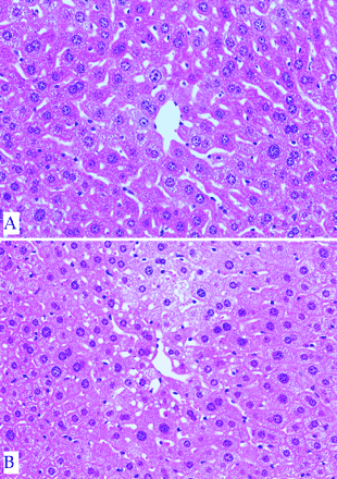 Photomicrographs of livers from a wild-type mouse (A) and a homozygous nrf2 knockout mouse (B) 2 h after exposure to 300 mg/kg APAP (po). Slight degeneration of centrilobular hepatocytes with small cytoplasmic vacuoles present in the knockout mouse liver. H&E. Magnification ×152.