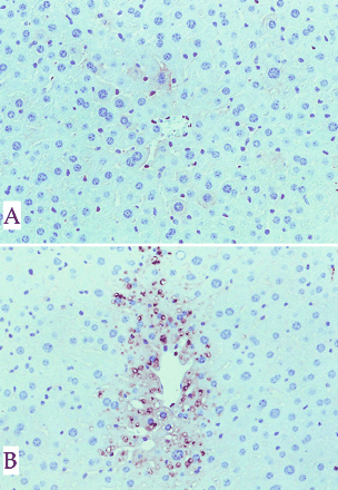 Immunohistochemical staining for APAP in livers from the same groups as in Figure 4. Negative and positive staining can be seen in centrilobular hepatocytes of wild-type (A) and knockout (B) mouse livers, respectively. Magnification ×152.
