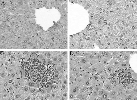 Histology of liver of the mice killed after 7 days: control (A), vitamin A (B), a single oral dose of 40 μg /kg TCDD (C), and vitamin A + single oral dose of 40 μg /kg TCDD (D). Control and vitamin A-treated livers demonstrate normal histology with sinusoids clearly visible between plates of uniform hepatocytes. TCDD-treated liver shows focal necrosis with inflammatory cell infiltration. In vitamin A + TCDD–treated mice, the magnitude of liver injury is less severe than that in the TCDD-treated mice. Original magnification 300×.