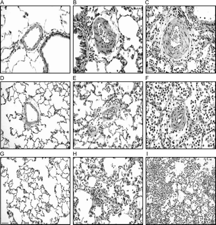 Photomicrographs of pulmonary tissue in blank filter (A, D, and G), PM100 (B, E, and H) and PM500 (C, F, and I) groups. A to C: The figures show peribronchiolar arterioles with decreased L/W ratio in PM500 group (C), secondary to vasoconstriction. D to F: The intra-acinar arterioles show vasoconstriction and decrease in L/W ratio in both 100PM (E) and 500PM (F) groups as compared with blank filter (D). Note the periarteriolar inflammation in the PM groups. G to I: Acute alveolar inflammation is observed in both PM groups (H and I), which is more pronounced in the animals exposed to higher PM dose (I). Scale bar in A, D, G, and I = 50 μm. Scale bar in B, C, E, F, and H = 25 μm.